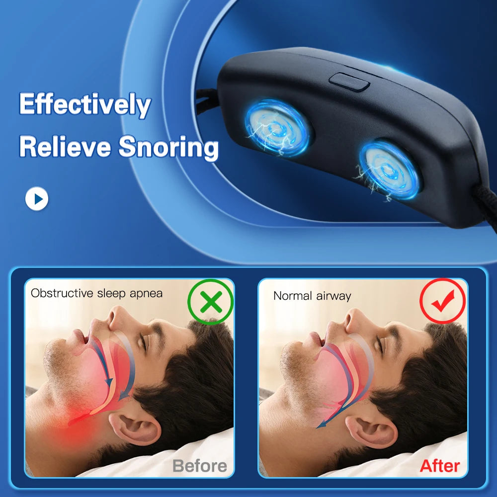 Pulse Stop Snore Portable Comfortable Sleep Well Stop Snore Health Care Sleep Apnea Aid USB Smart Anti Snoring Device