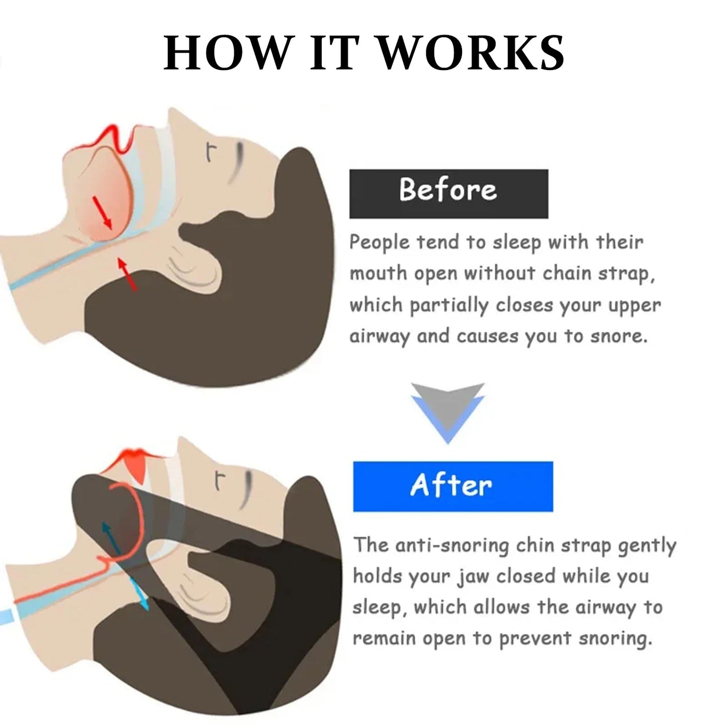 Anti-snoring Mouthpieces Chin Strap Sleep Care Breathable and Comfortable Anti Snore Belt for Men Women Daily Sleeping
